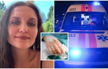 Ūžimas ausyje po koncerto atskleidė grėsmę: Airai aptiktos dvi galvos smegenų aneurizmos