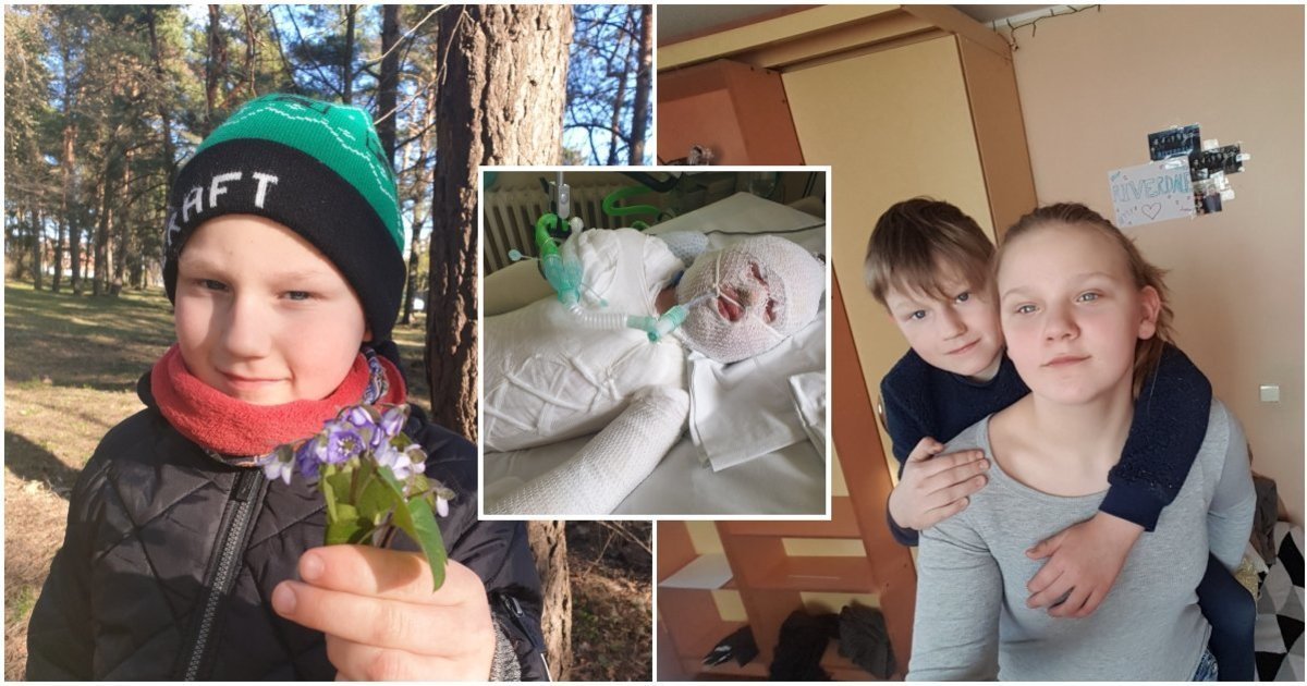 Po skaudžios nelaimės Lukas sulaukė didžiulės pagalbos: mama atskleidė, kaip jam sekasi po šešerių metų