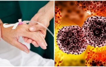 Prostatos vėžys gali tylėti ilgai: kam priklauso nemokama patikra