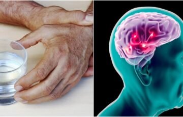 Michael J. Fox atvirai apie Parkinsono ligą: kasmet kasdienybė jam vis sunkesnė