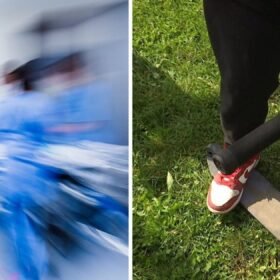 Paspirtukų chaosas gatvėse: chirurgams vis dažniau tenka gydyti vaikus
