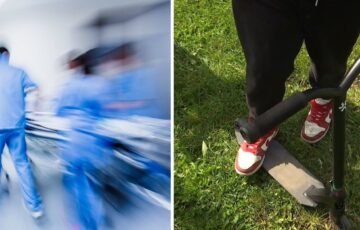 Paspirtukų chaosas gatvėse: chirurgams vis dažniau tenka gydyti vaikus