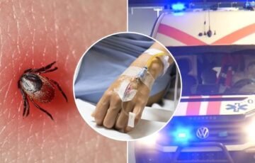 Erkės vis dar tyko sode: šie augalai ir priemonės gali padėti jų išvengti