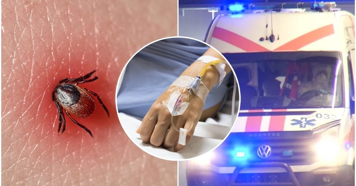 Erkės vis dar tyko sode: šie augalai ir priemonės gali padėti jų išvengti