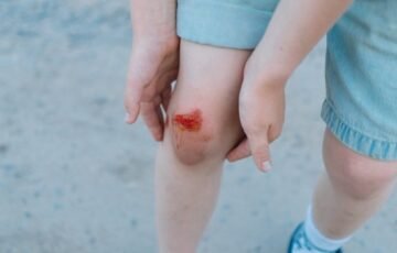 Trauma per kūno kultūrą gali pasirodyti menka: kada vaikui būtina medikų pagalba