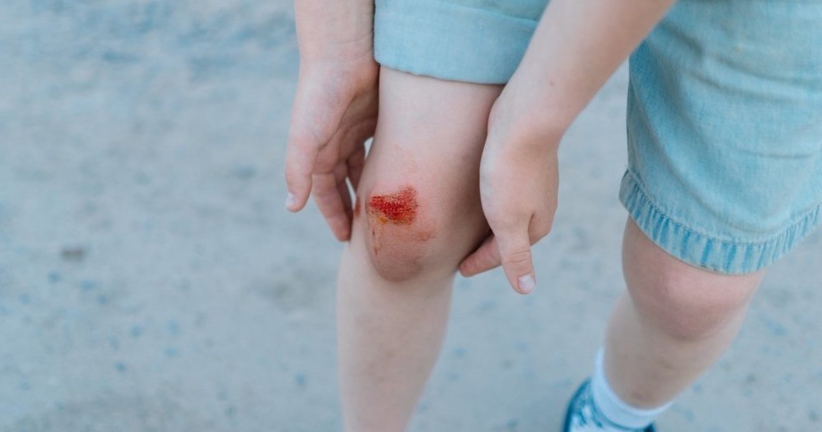 Trauma per kūno kultūrą gali pasirodyti menka: kada vaikui būtina medikų pagalba
