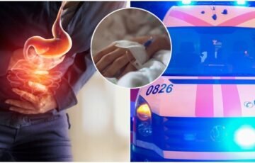Skrandžio vėžys gali slėptis po įprastais negalavimais: simptomai, kurių nereikėtų numoti ranka