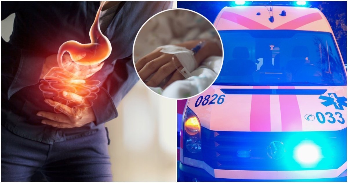 Skrandžio vėžys gali slėptis po įprastais negalavimais: simptomai, kurių nereikėtų numoti ranka