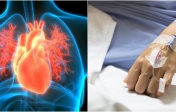 Širdies nepakankamumas gali prasidėti nepastebimai: 3 signalai, kurių ignoruoti pavojinga