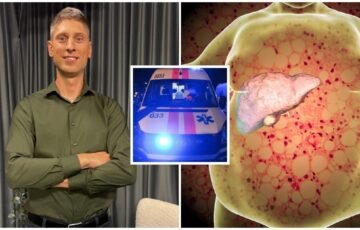 Suriebėjusios kepenys ilgai tyli: 5 ženklai gali įspėti apie rimtą pavojų