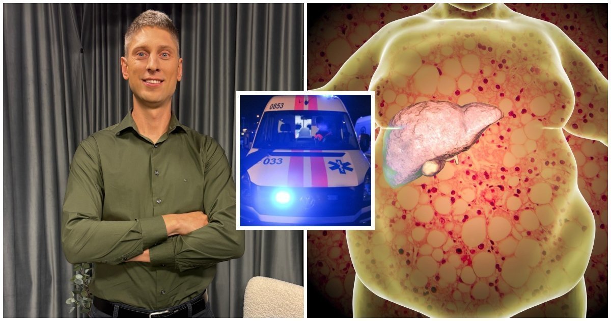 Suriebėjusios kepenys ilgai tyli: 5 ženklai gali įspėti apie rimtą pavojų