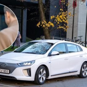 Išsiplėtusios kojų venos – ne vien grožio problema: kada būtina sunerimti ir kaip sau padėti