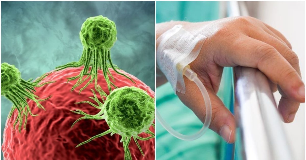 Vėžio gydymą vis dar gaubia mitai: ką būtina žinoti apie chemoterapiją, sportą ir cukrų