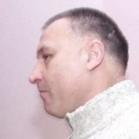 Veterinarą sukrėtė žmonių žiaurumas: kai kurių gyvūnų sužalojimai aptinkami visai netikėtai