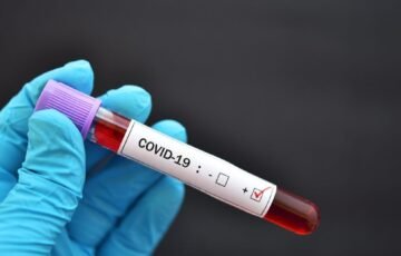 Greitųjų COVID-19 testų byla artėja prie atomazgos: kada teismas skelbs sprendimą L. Jaruševičienės byloje