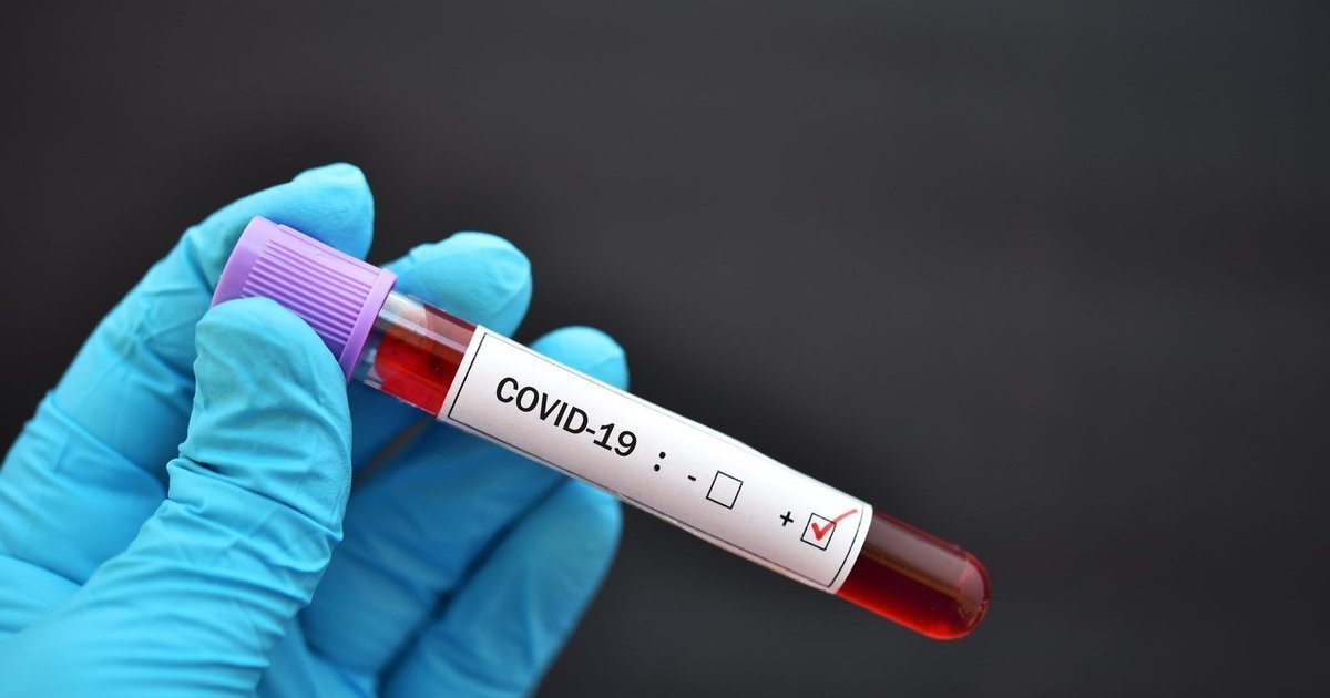 Greitųjų COVID-19 testų byla artėja prie atomazgos: kada teismas skelbs sprendimą L. Jaruševičienės byloje